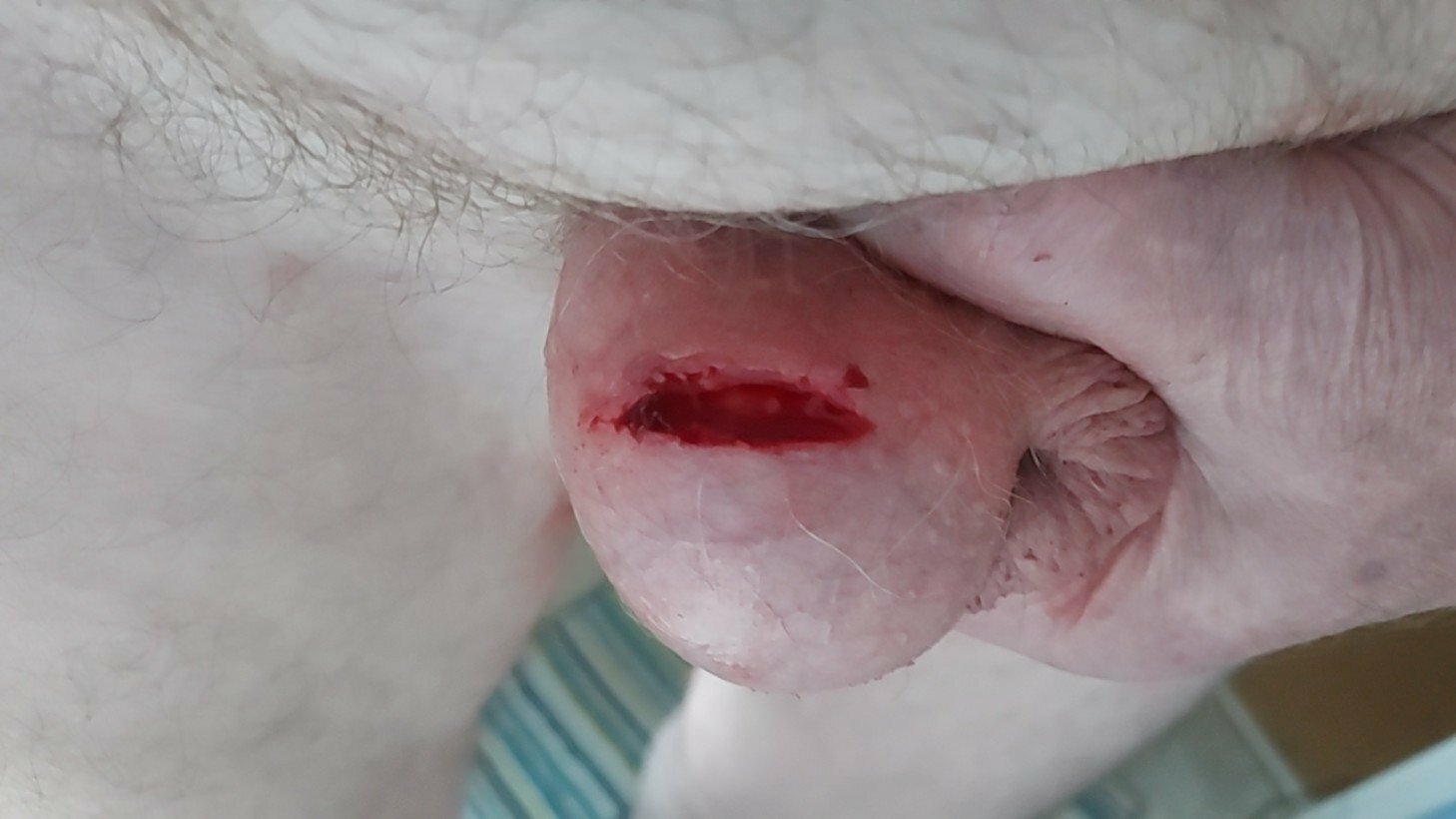 brumeato / scrotum cut open