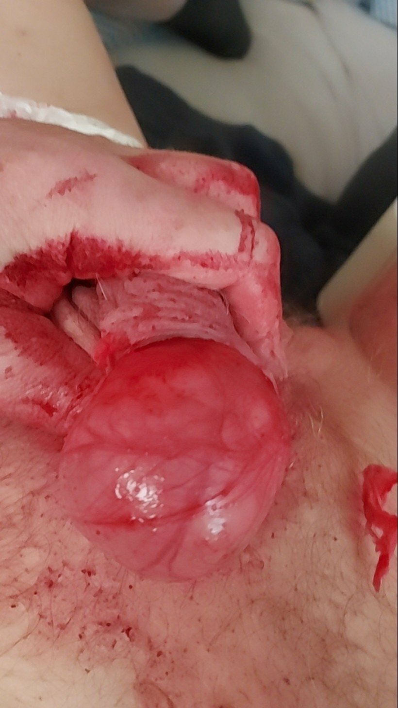 brumeato / scrotum cut open