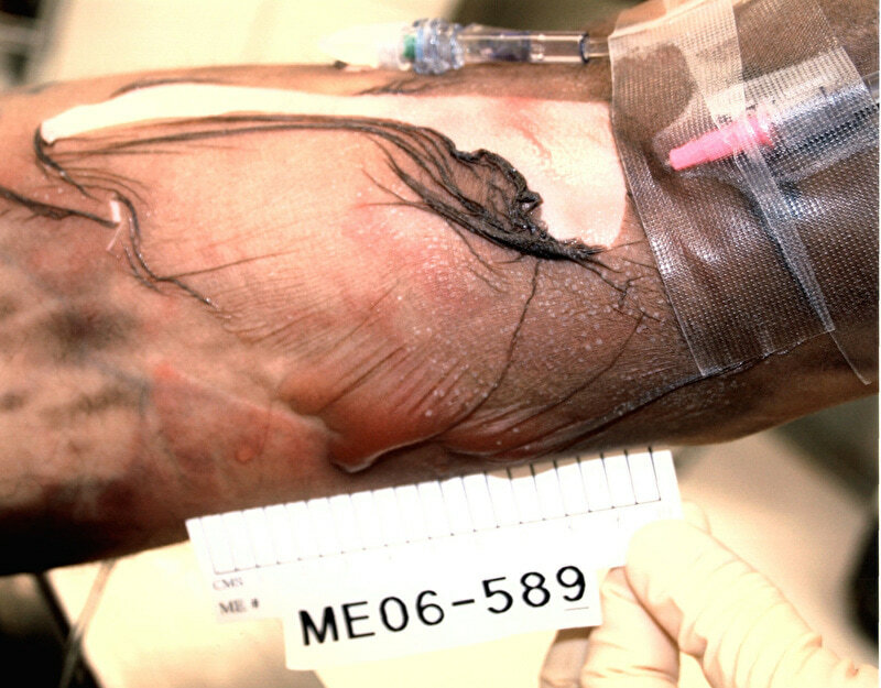 Lethal Injection Site Gallery