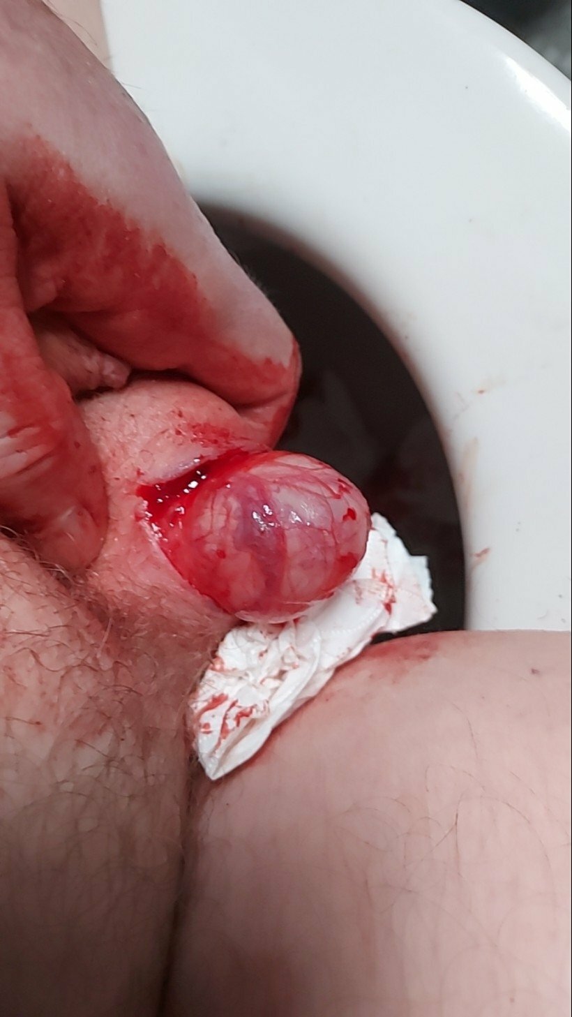 brumeato / scrotum cut open