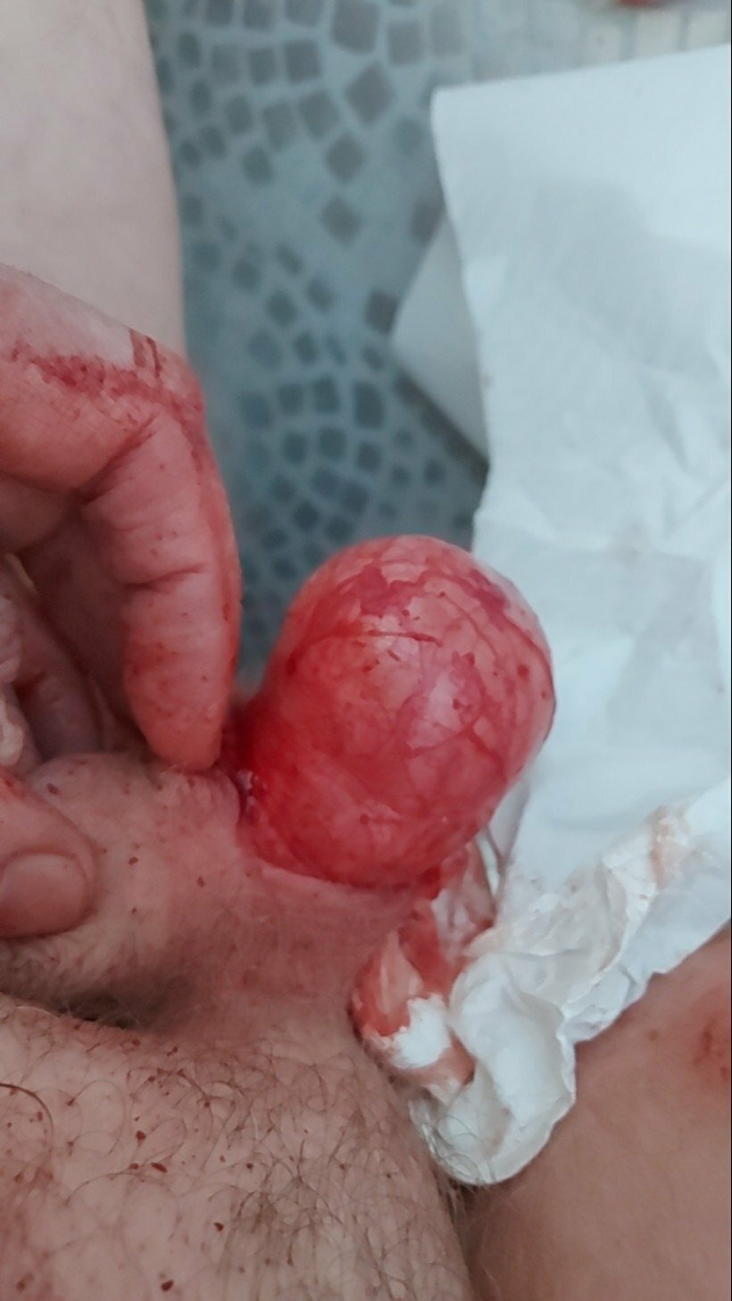 brumeato / scrotum cut open