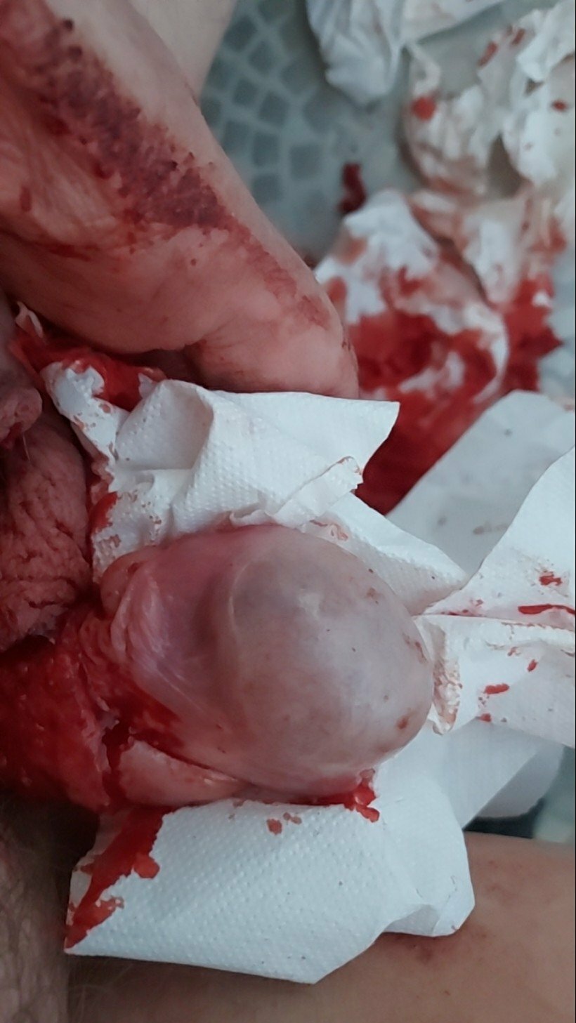 brumeato / scrotum cut open