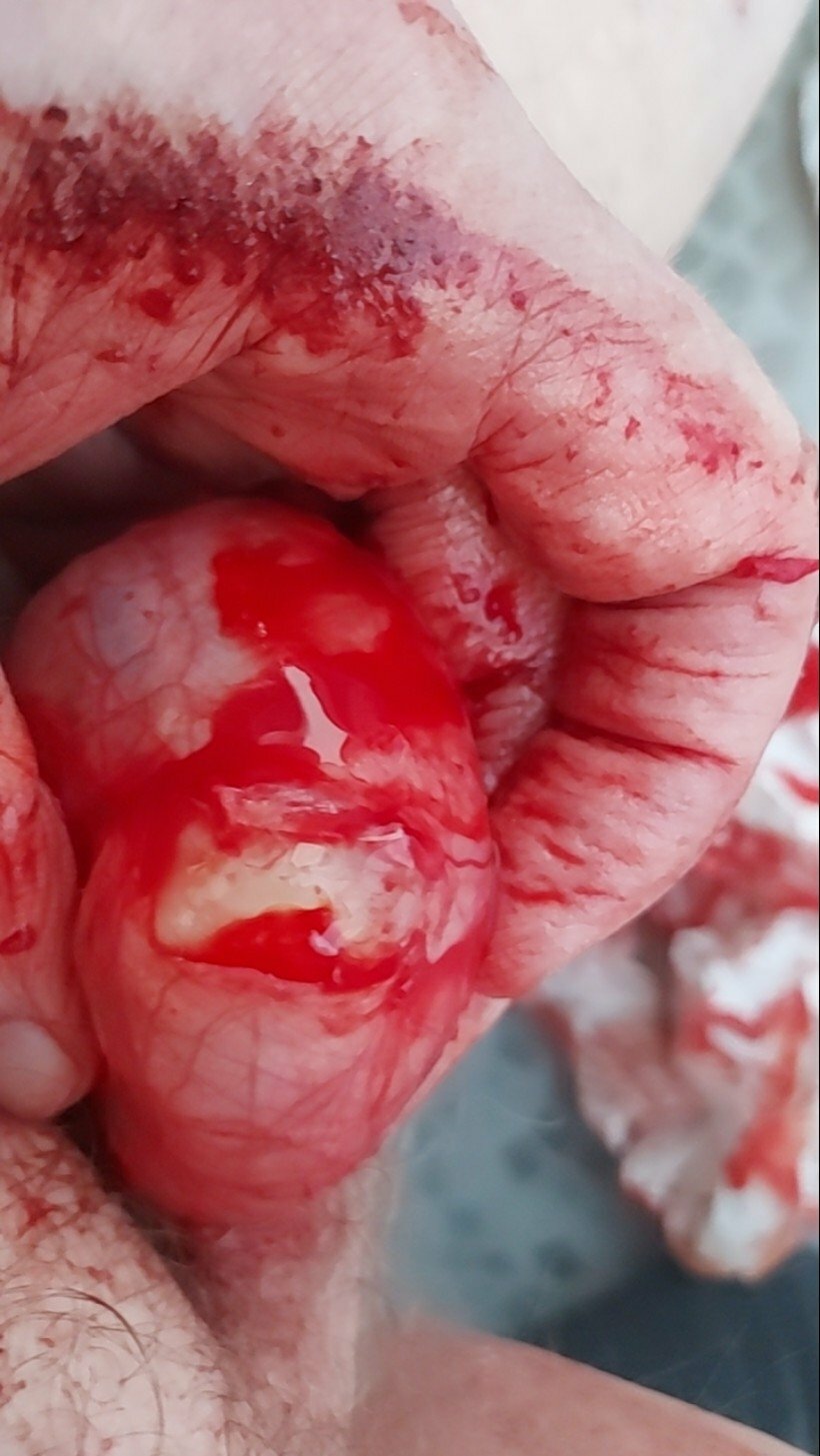 brumeato / scrotum cut open