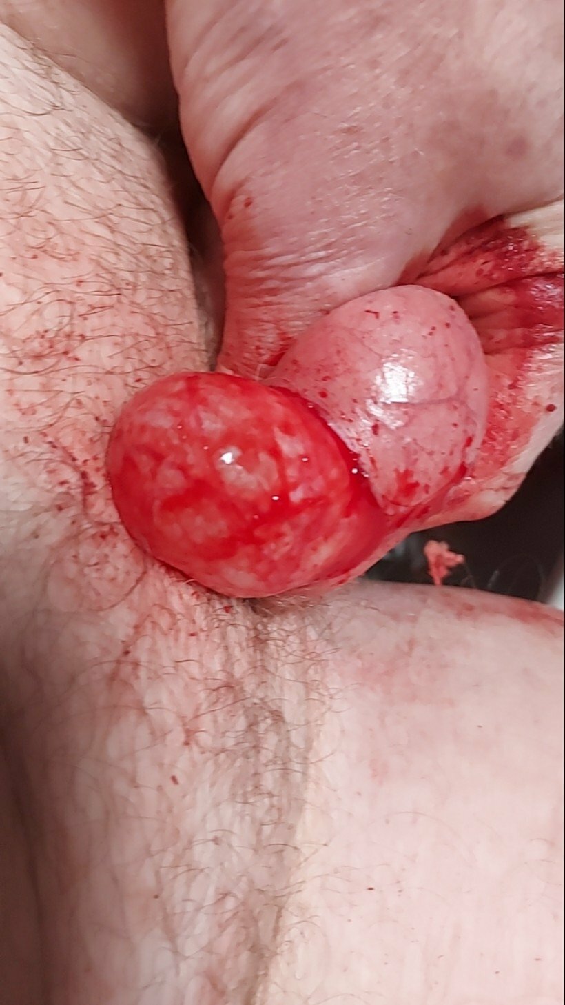 brumeato / scrotum cut open