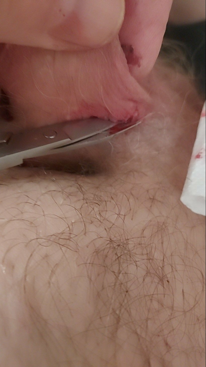 brumeato / scrotum cut open