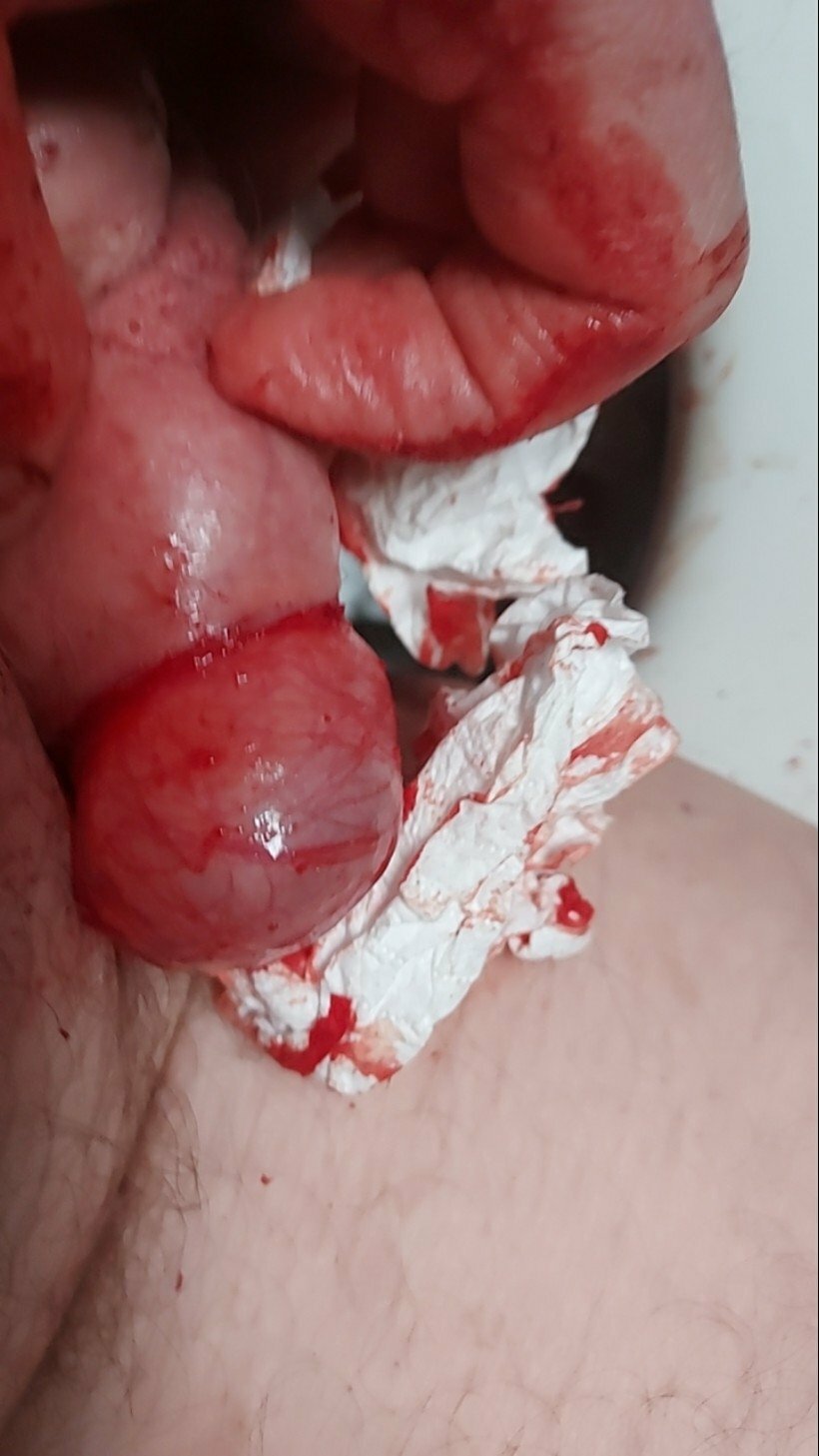 brumeato / scrotum cut open