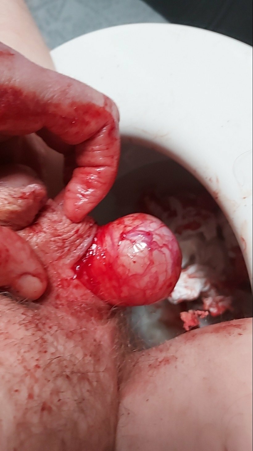 brumeato / scrotum cut open