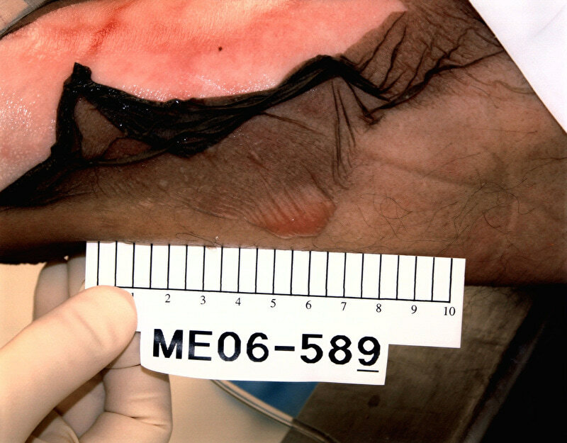 Lethal Injection Site Gallery