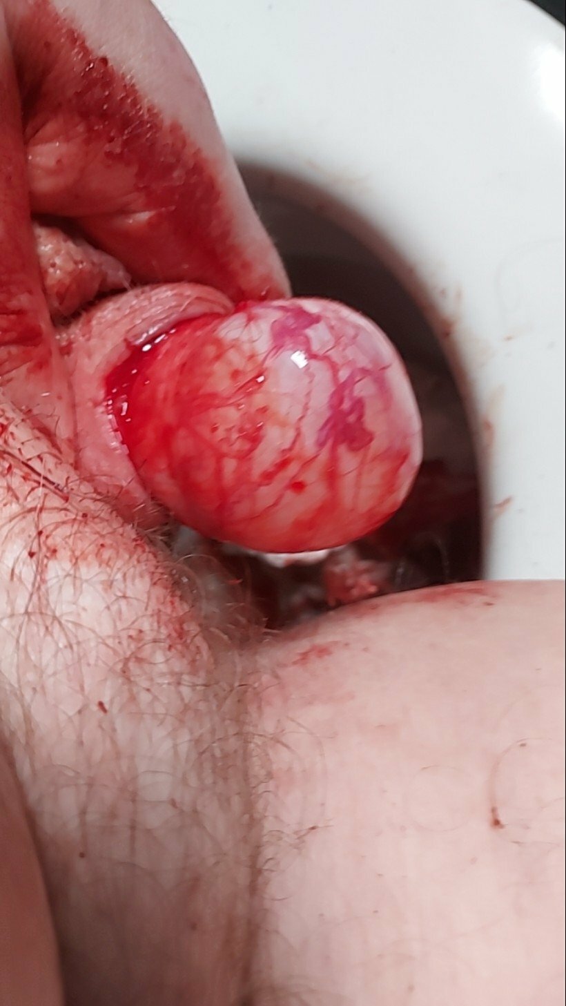 brumeato / scrotum cut open