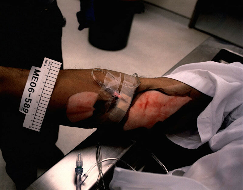 Lethal Injection Site Gallery