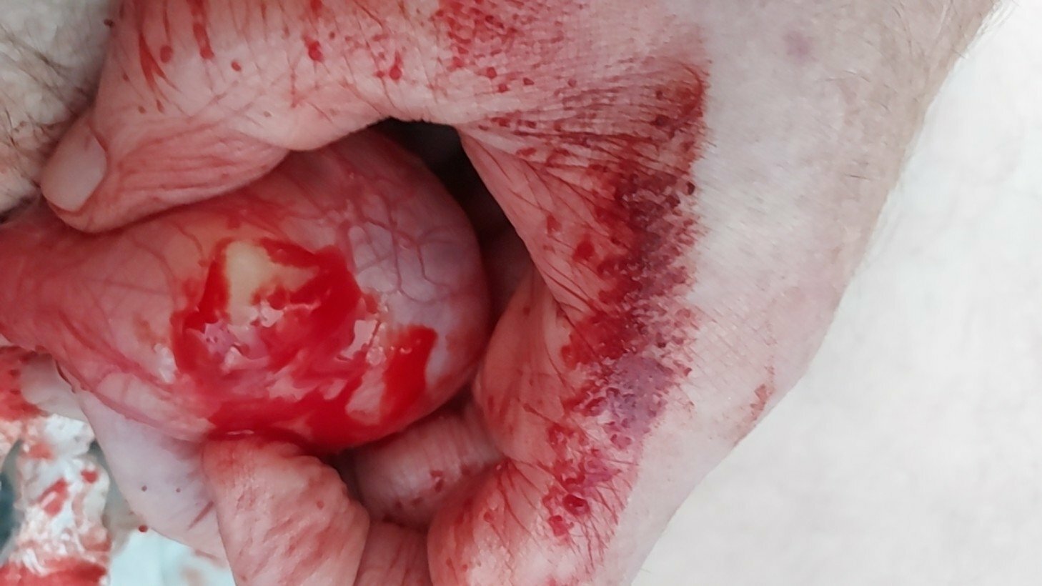 brumeato / scrotum cut open