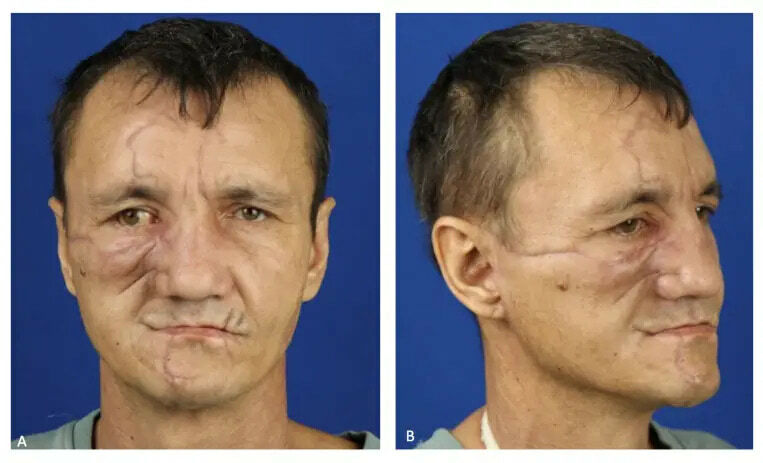 Bear Face Reconstruction Gallery