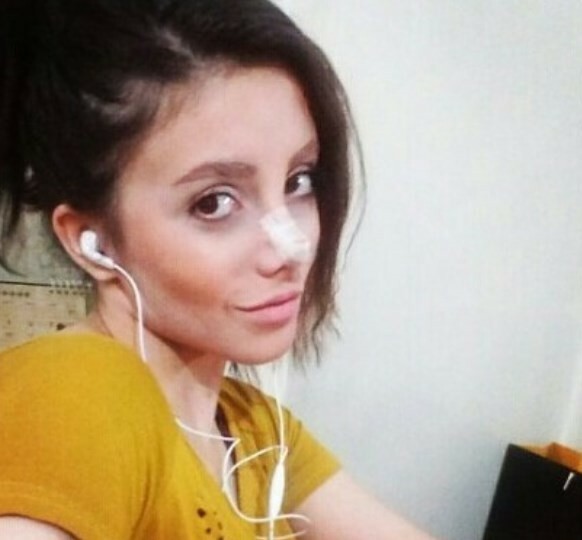 Woman had 50 surgeries to look like Angelina Jolie but the surgery went wrong
