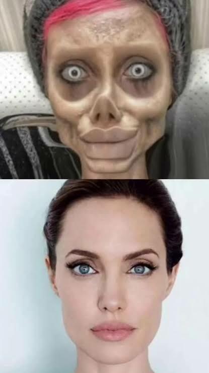 Woman had 50 surgeries to look like Angelina Jolie but the surgery went wrong