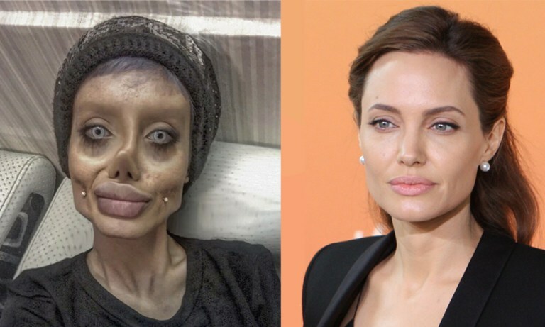 Woman had 50 surgeries to look like Angelina Jolie but the surgery went wrong