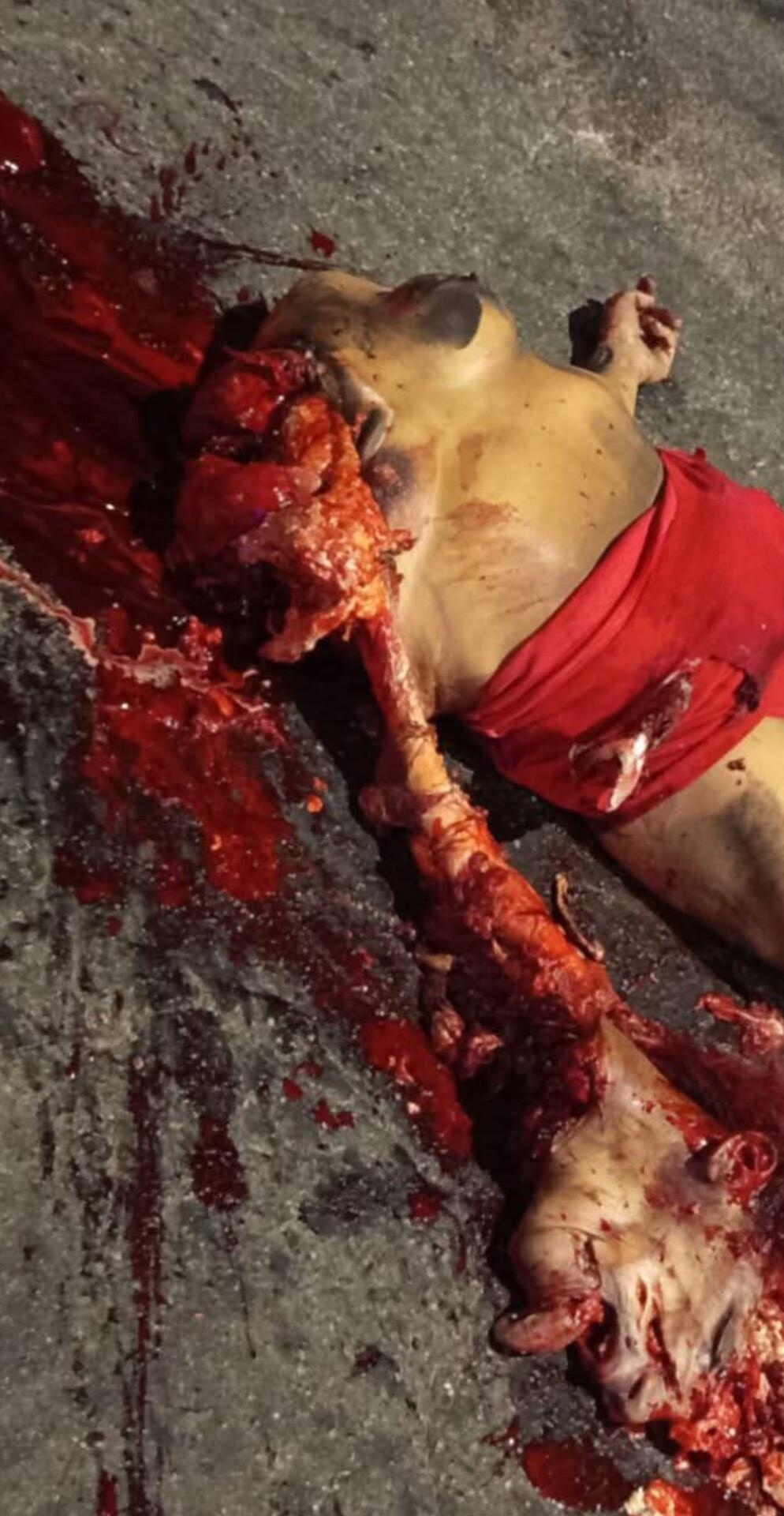 Gruesome aftermath of a collision between a bus and a woman