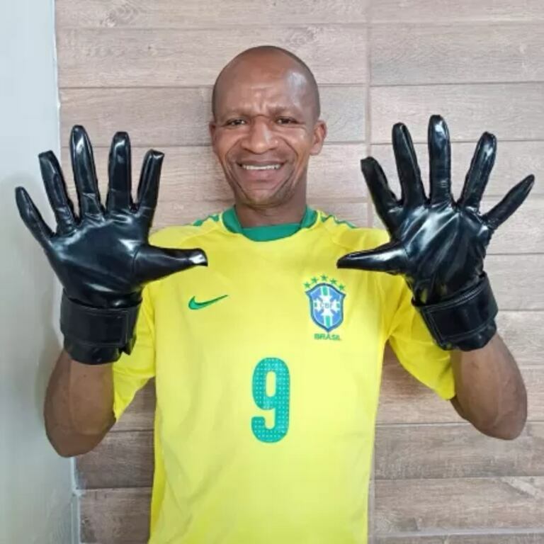 homem com 6 dedos em cada mão