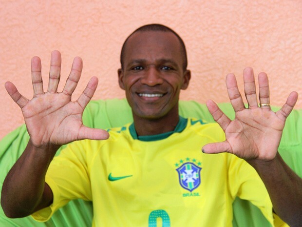 homem com 6 dedos em cada mão