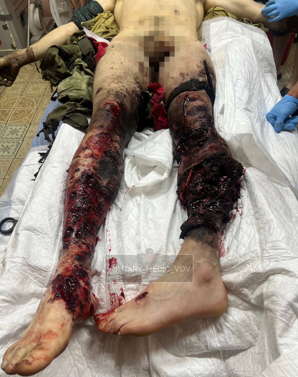 Product of a Ukrainian FPV Strike on a VDV Convoy