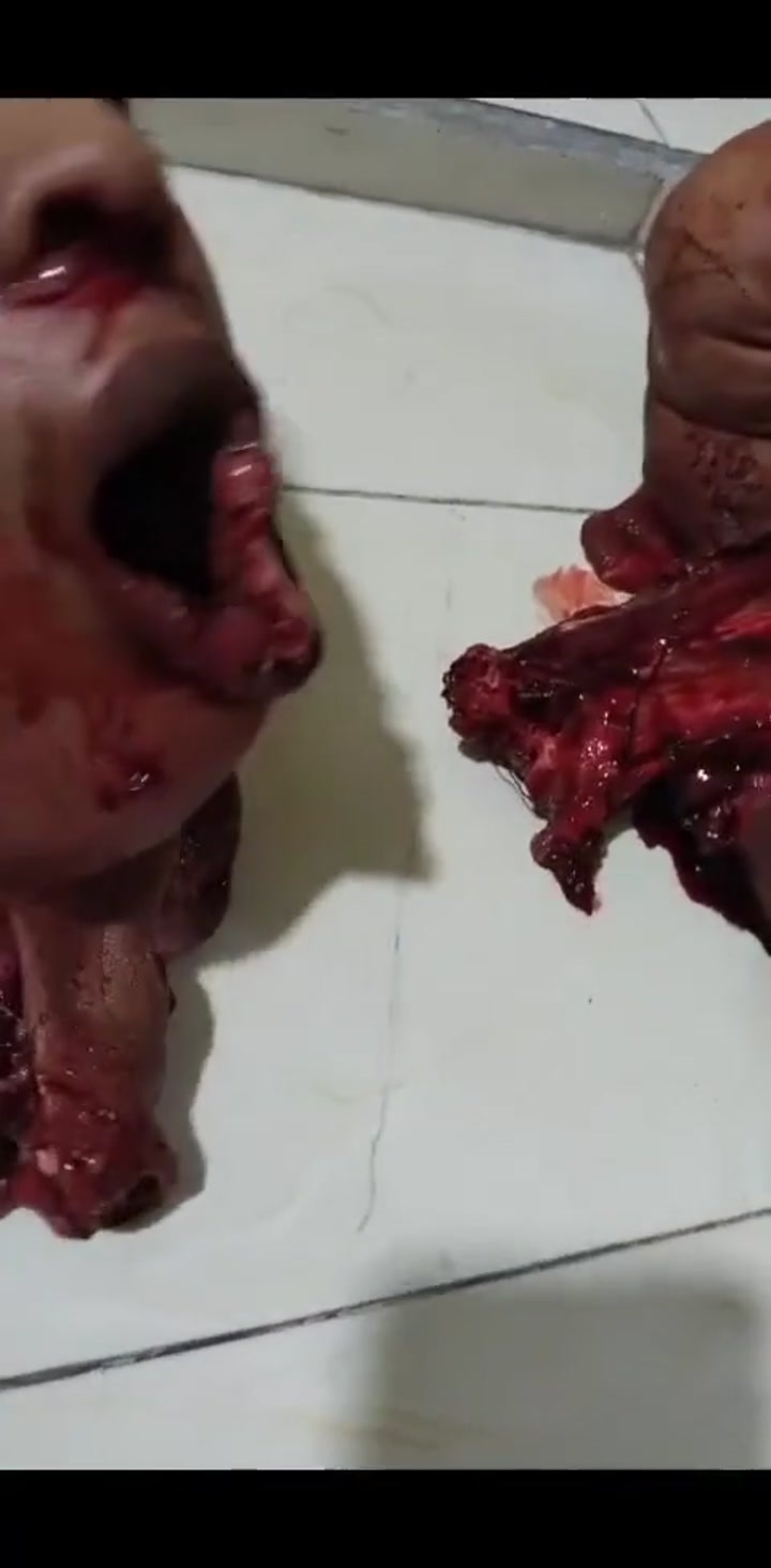 a man with his head cut off after hitting a road barrier that was being ...