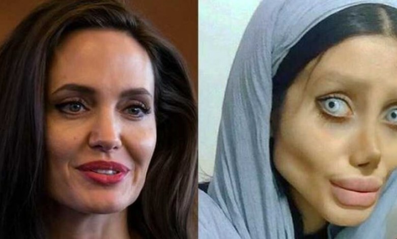 Woman had 50 surgeries to look like Angelina Jolie but the surgery went wrong