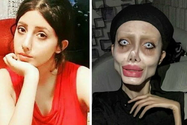 Woman had 50 surgeries to look like Angelina Jolie but the surgery went wrong