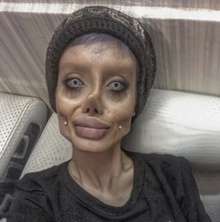 Woman had 50 surgeries to look like Angelina Jolie but the surgery went wrong