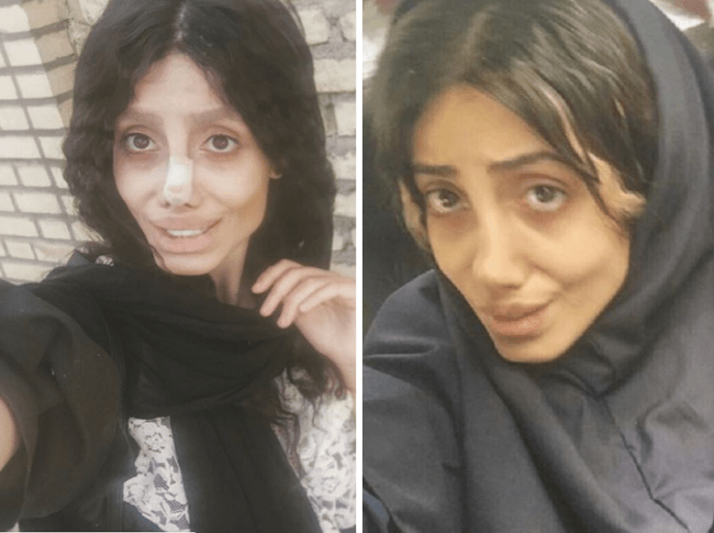 Woman had 50 surgeries to look like Angelina Jolie but the surgery went wrong