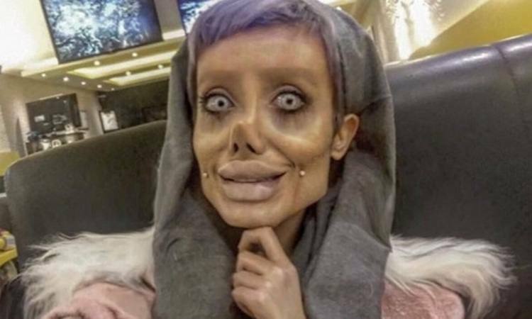 Woman had 50 surgeries to look like Angelina Jolie but the surgery went wrong