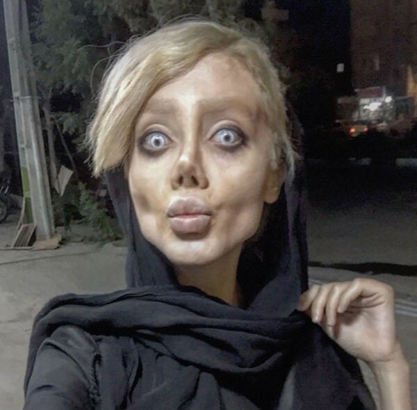 Woman had 50 surgeries to look like Angelina Jolie but the surgery went wrong