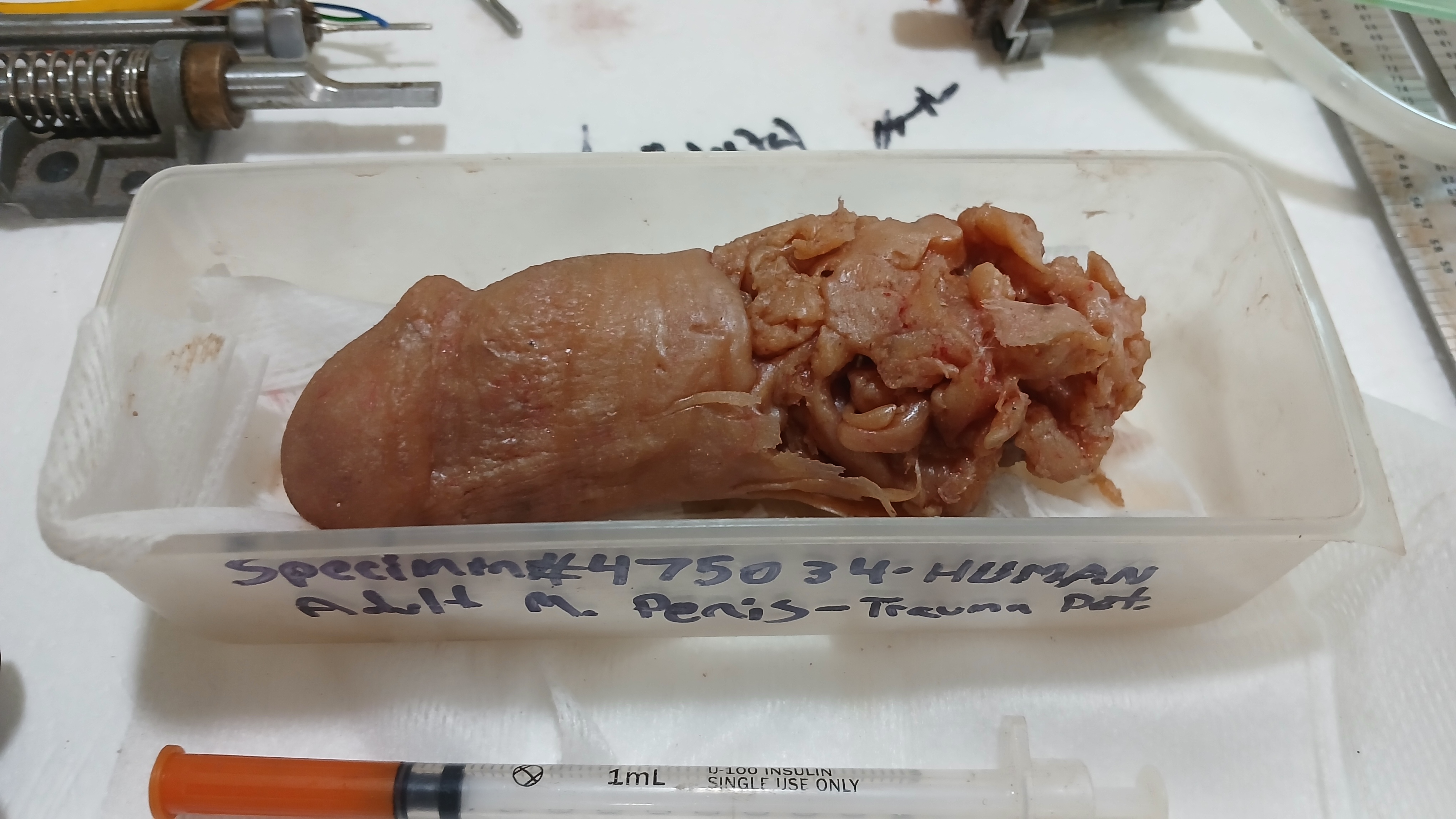 Detached penis examined