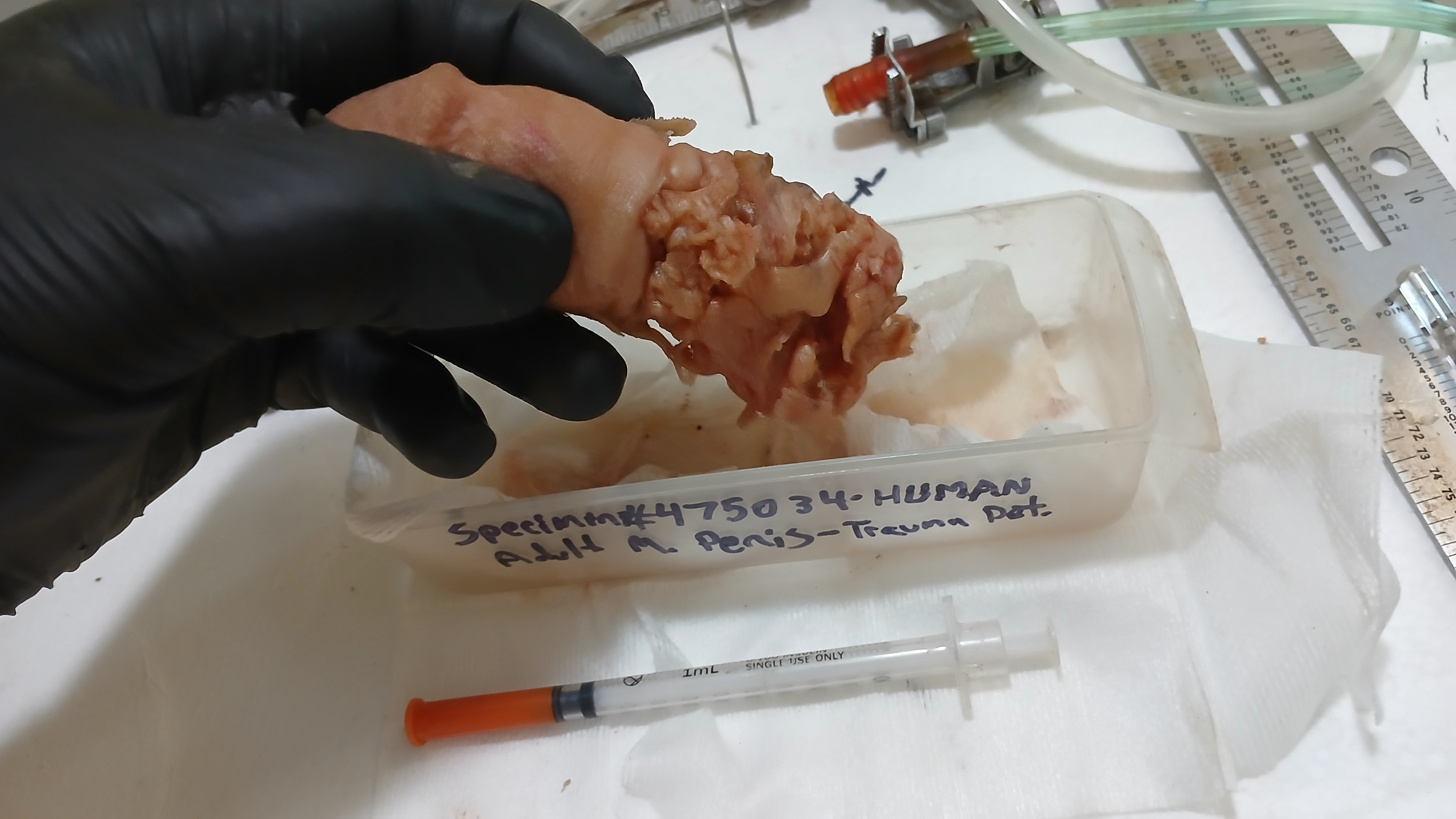 Detached penis examined