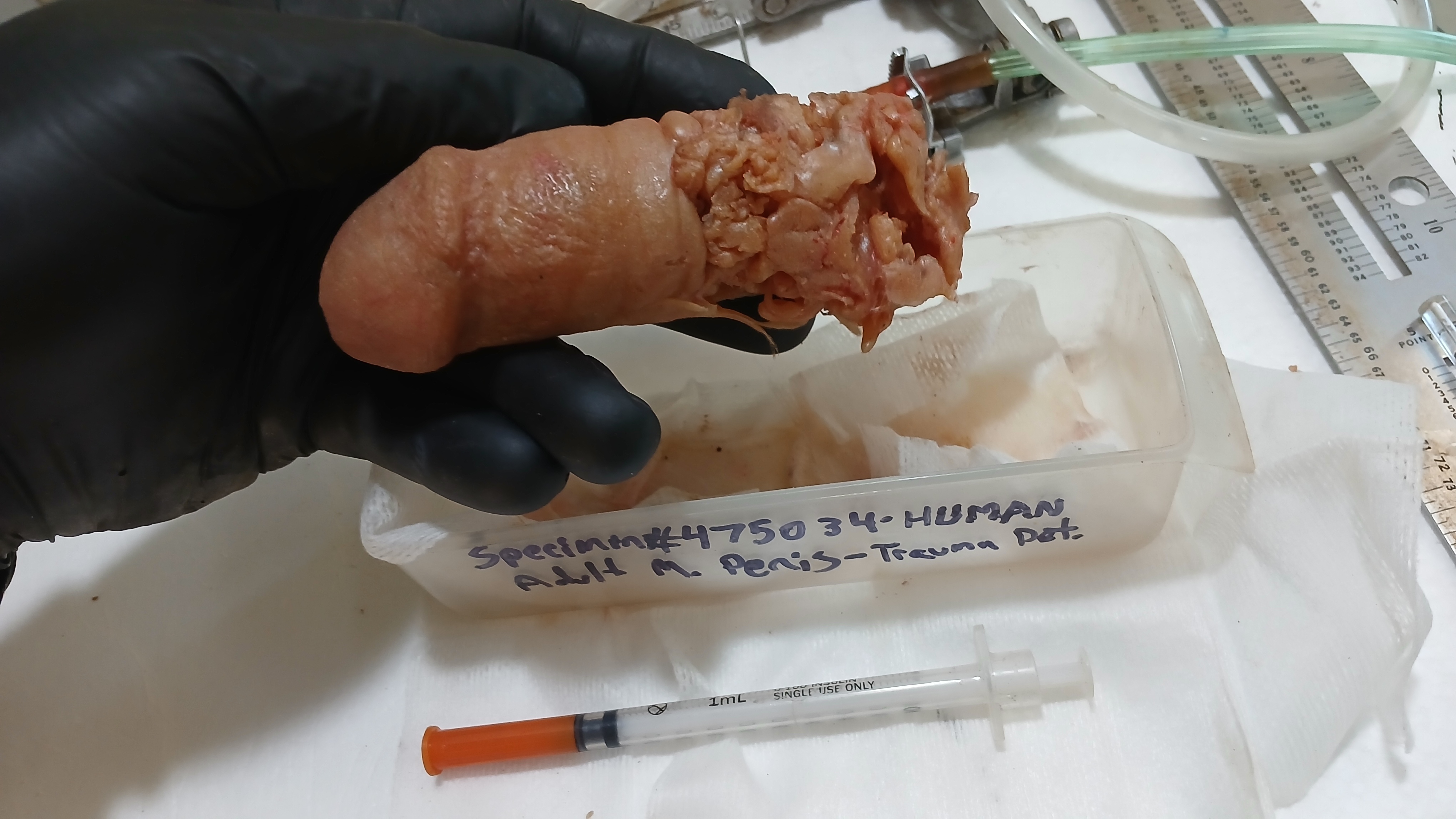 Detached penis examined