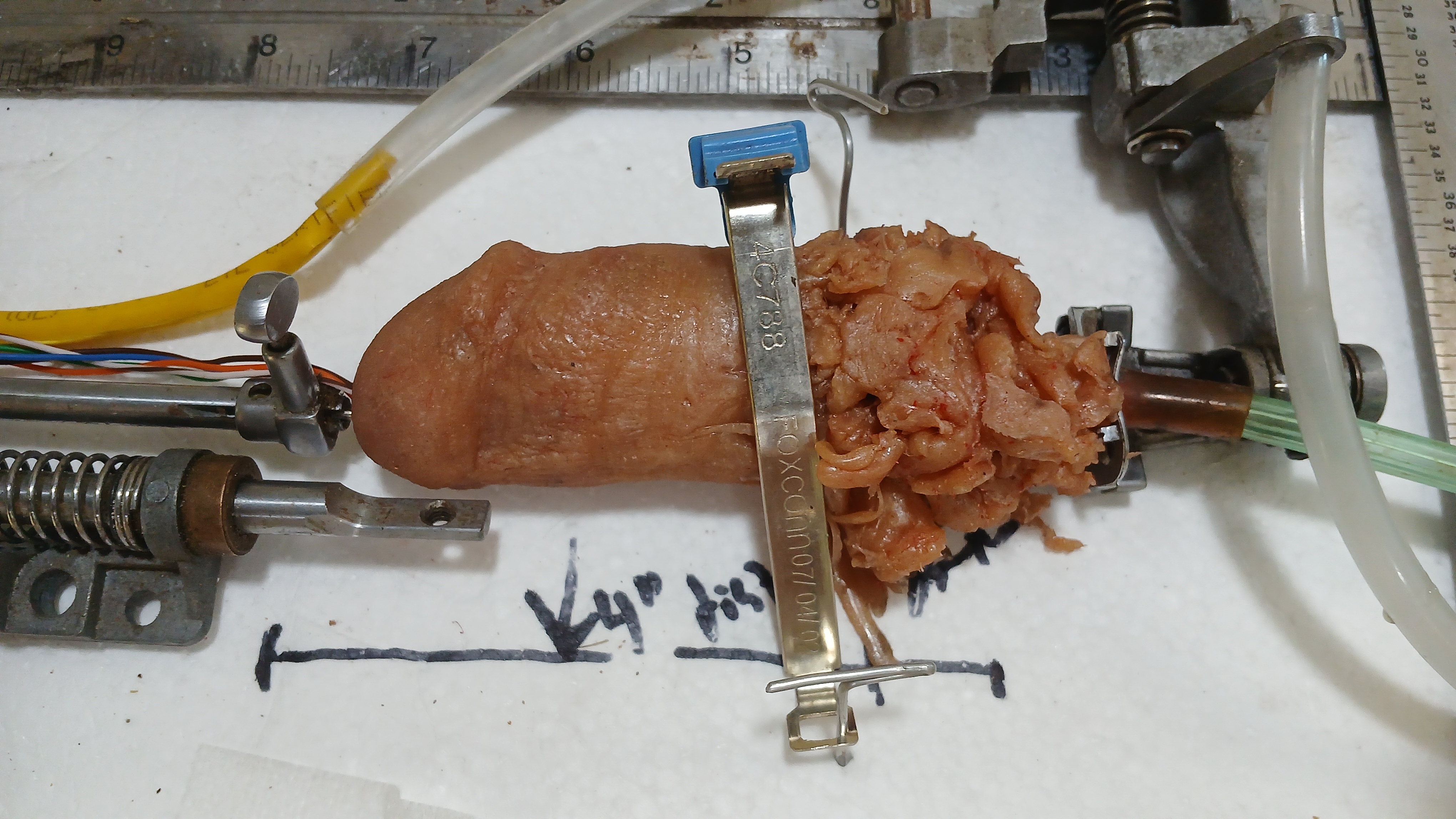 Detached penis examined