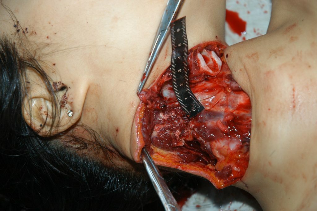 autopsy of a slaughtered woman