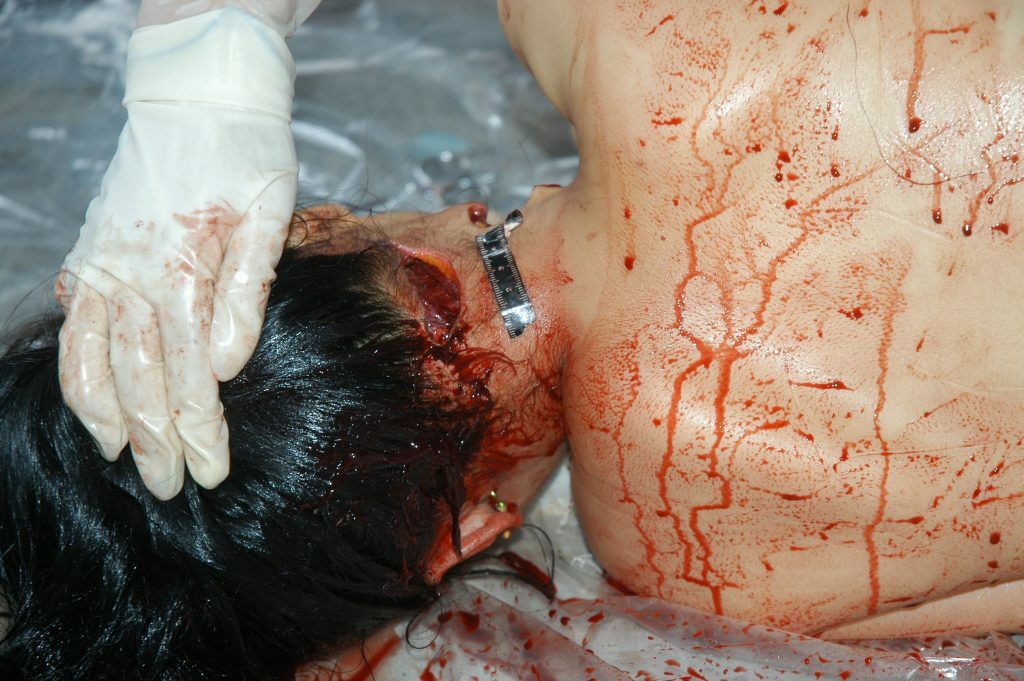 autopsy of a slaughtered woman