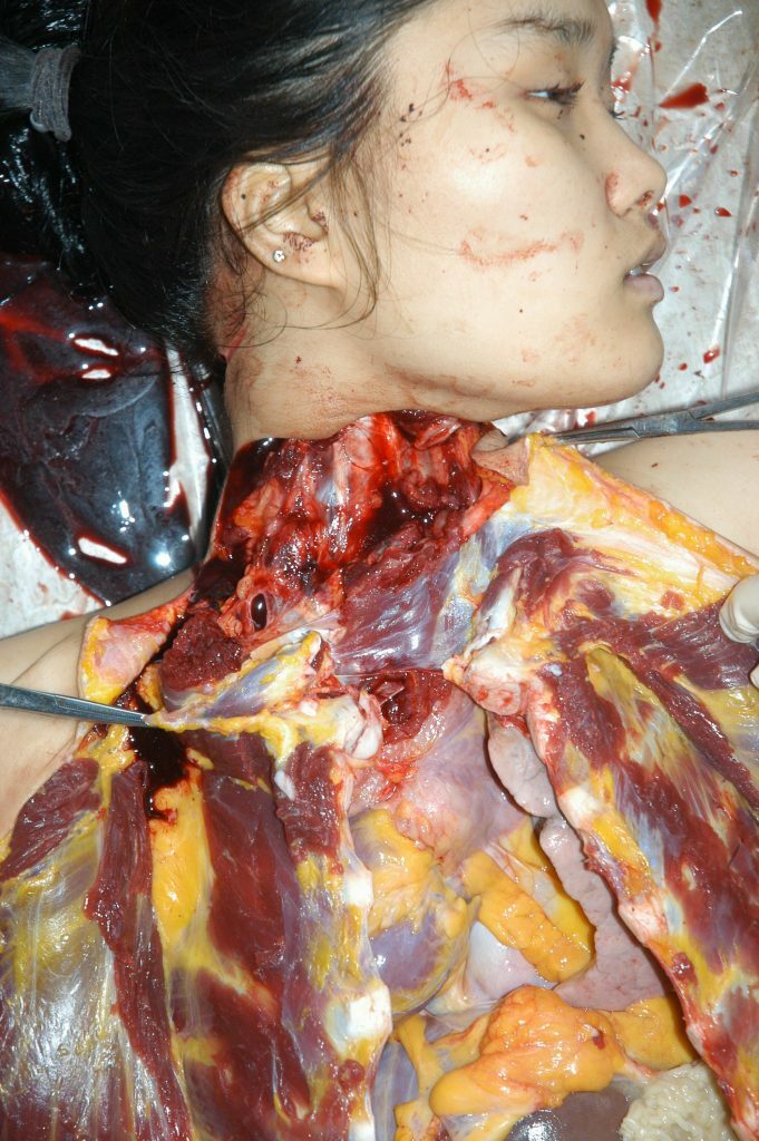 autopsy of a slaughtered woman