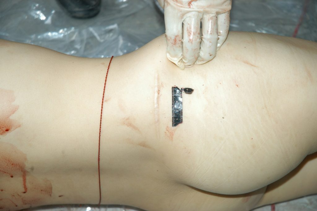 autopsy of a slaughtered woman