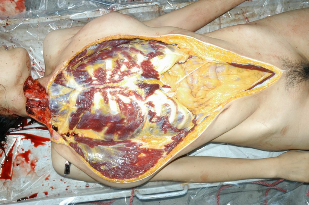 autopsy of a slaughtered woman