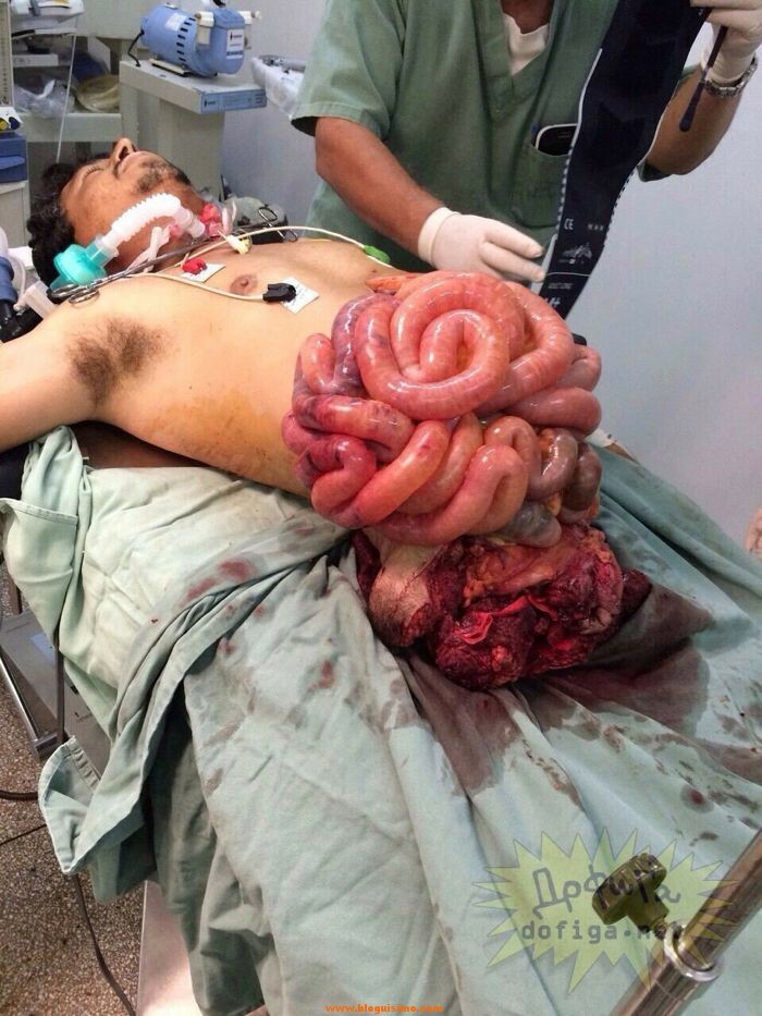 The man slipped at work