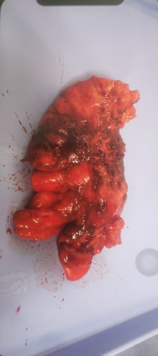 Guess which organ it is and win a beer