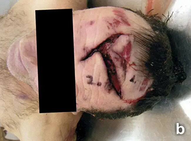 Deer Don't Accept Checks