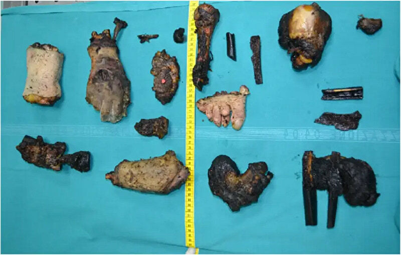 Son Kills, Necros, Eats Mommy