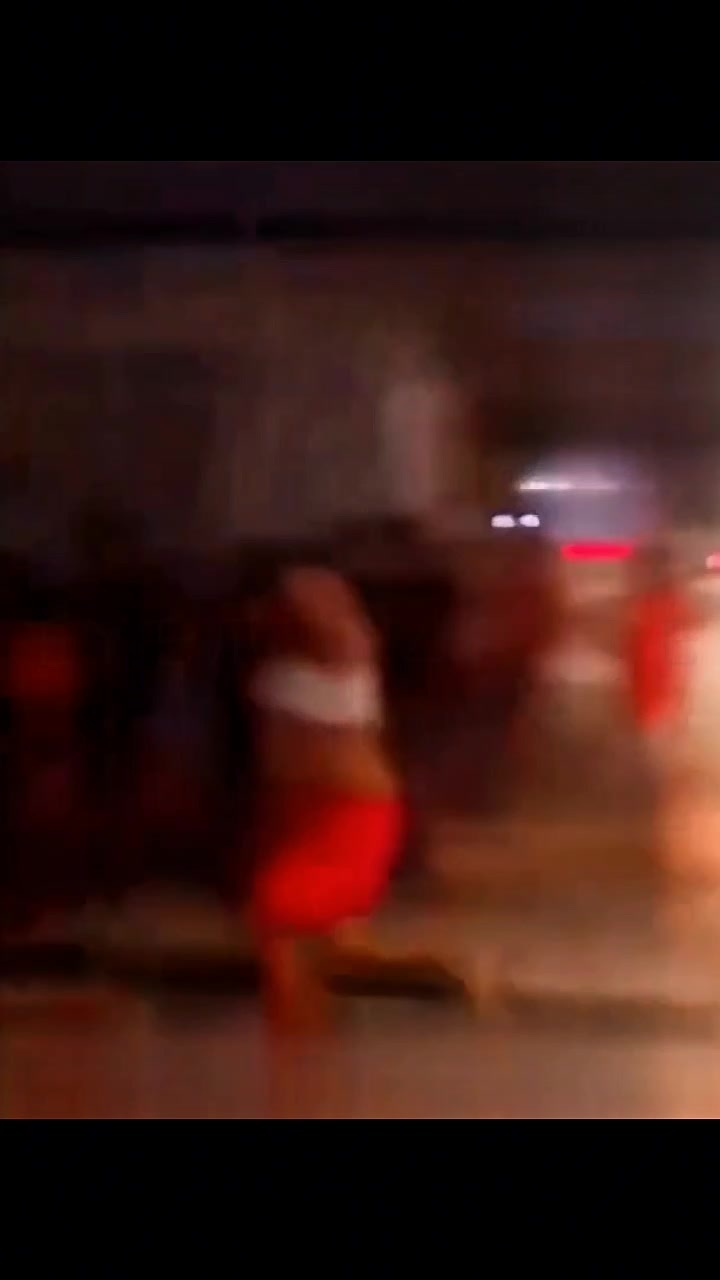 Idiot lost his right arm