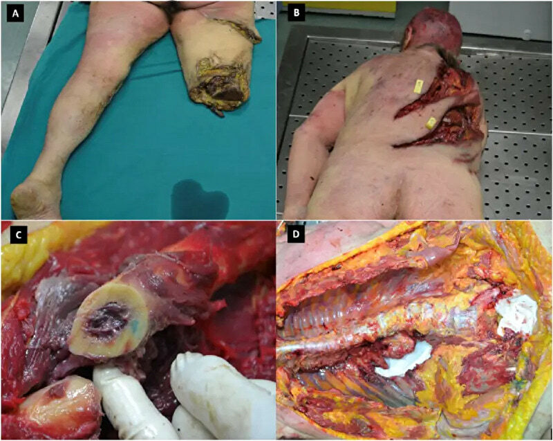 Son Kills, Necros, Eats Mommy