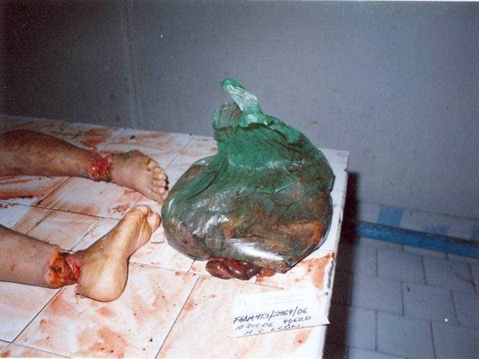 Her attacker was a cannibal