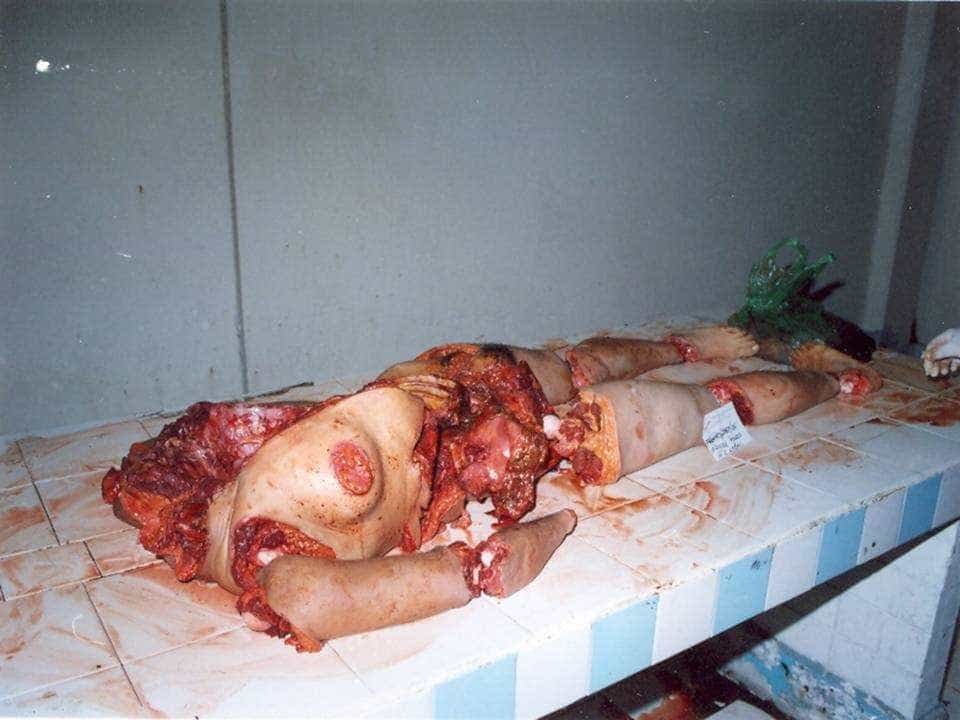 Her attacker was a cannibal