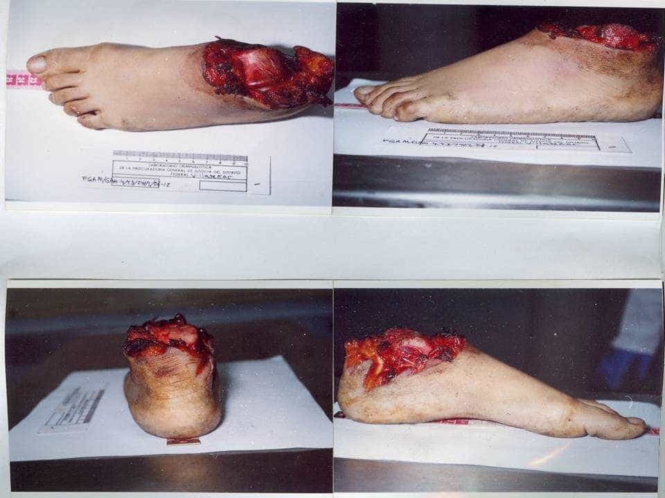 Her attacker was a cannibal