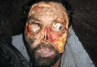 An Old Fashion Dumping