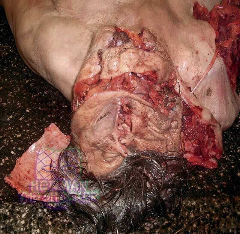 Open Casket Reconstruction